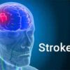 Pencegahan dan penanganan Stroke dengan Konsep Karnus